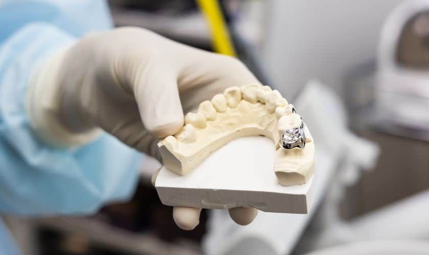 How To Remove Dental Cement From Crown?