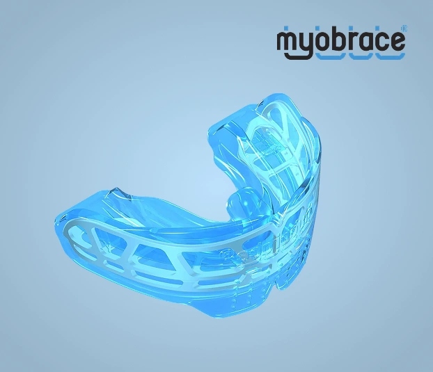 Myobrace clear aligner tray for early orthodontics treatment in Aurora, IL.
