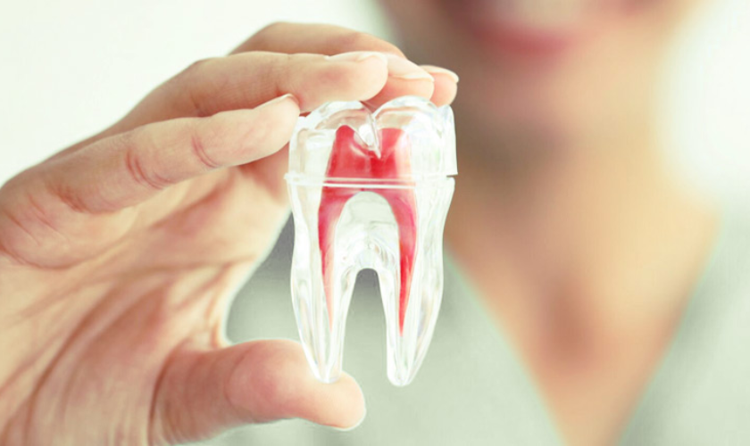 Common Signs You Need a Root Canal
