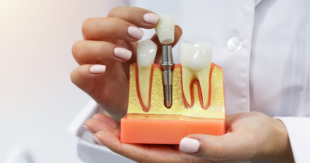 Dental Implants and Aging