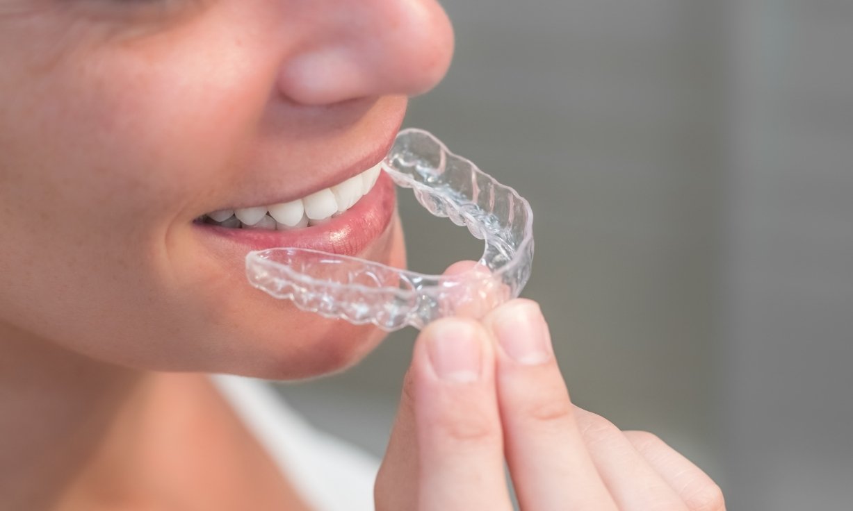 how to care for your myobrace appliance