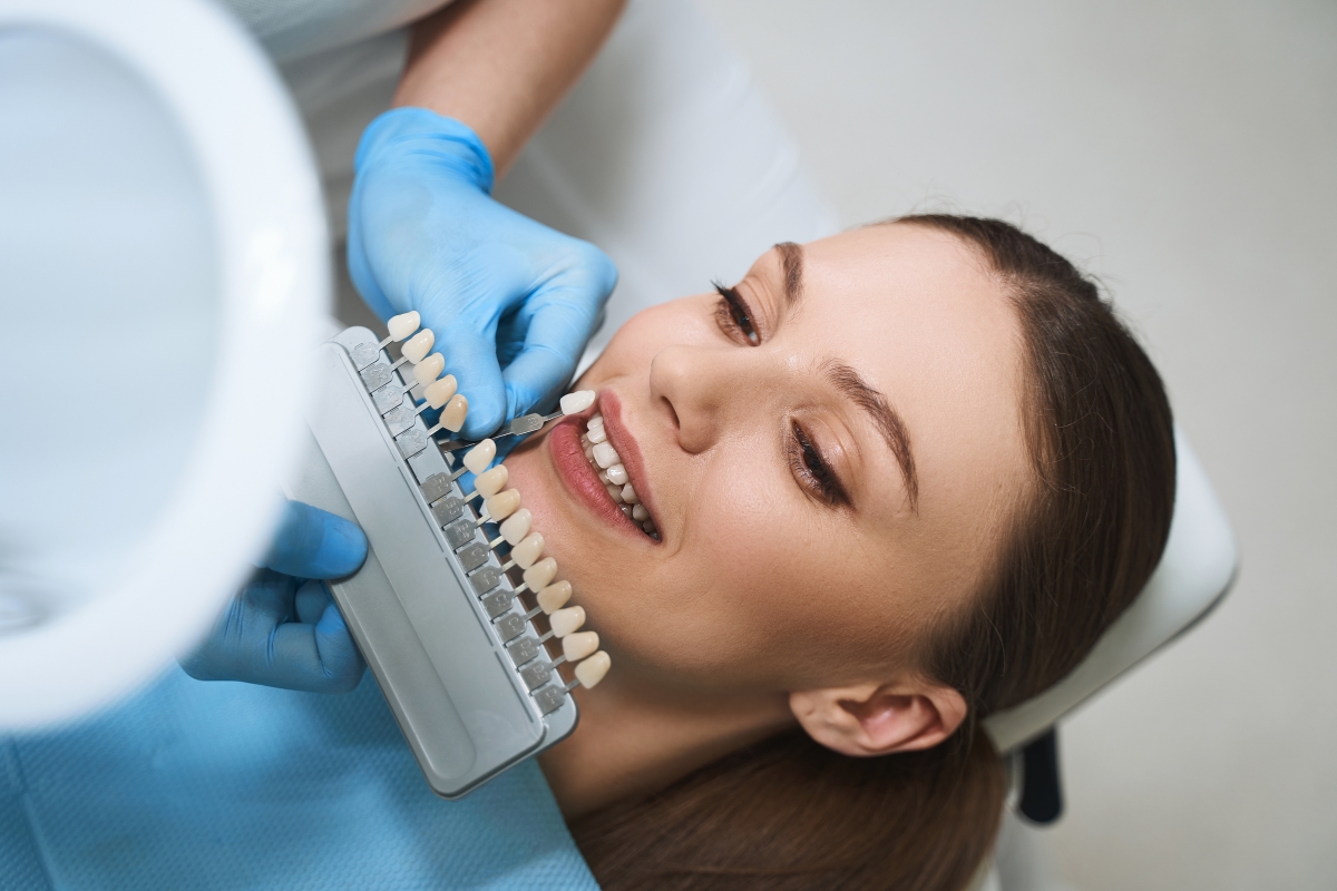 Dental-Veneers-in-Aurora