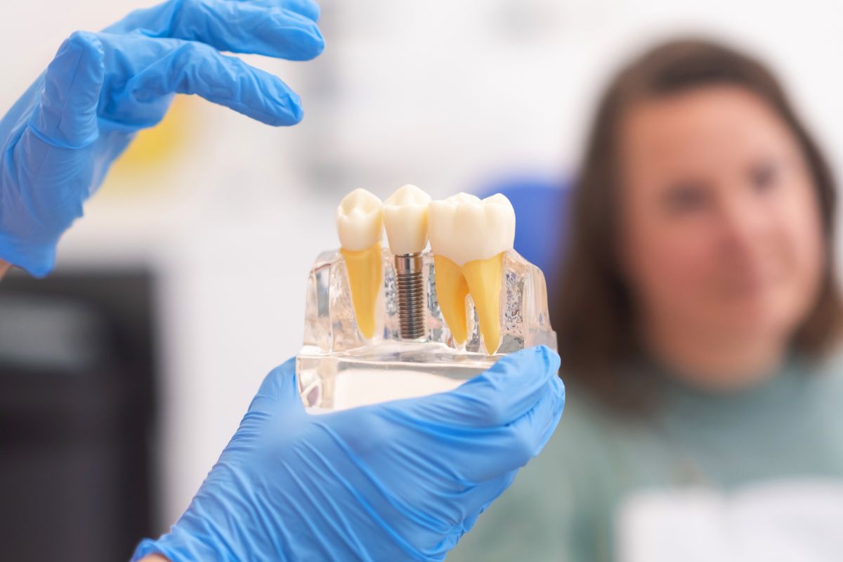 When is It Too Late to Get Dental Implants
