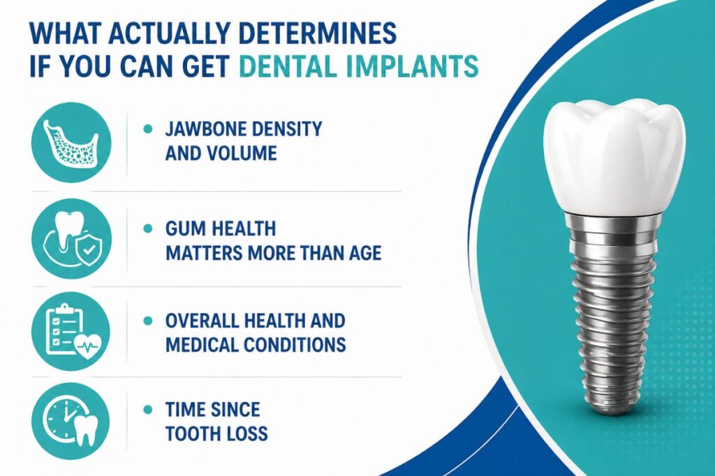 What Actually Determines If You Can Get Dental Implants