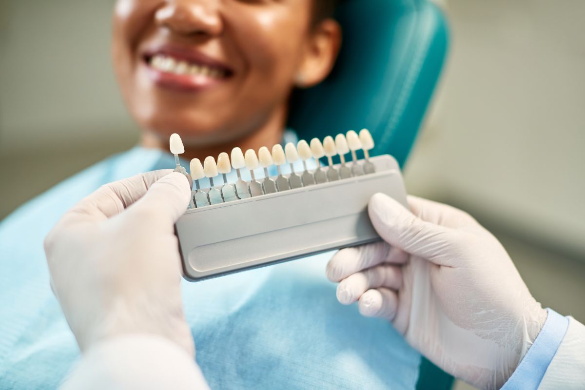 how much do veneers cost